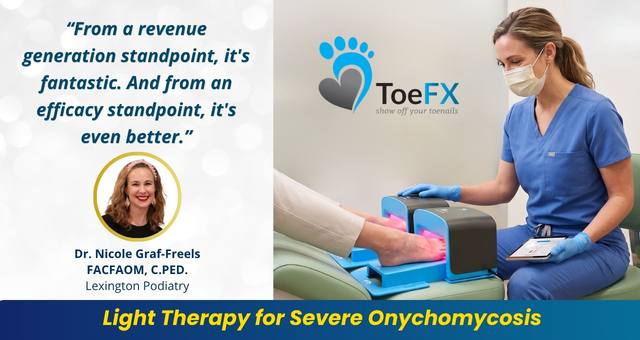 toeFXmay2526